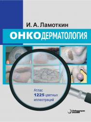 Онкодерматология : атлас : учебное пособие. — 2-е изд., электрон. ISBN 978-5-93208-556-1