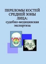 Переломы костей средней зоны лица: судебно-медицинская экспертиза : пособие ISBN 978-985-06-2518-2